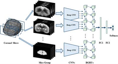 Classification of Alzheimer’s Disease by Combination of Convolutional and Recurrent Neural Networks Using FDG-PET Images